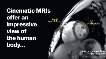 为了研究人类*行为性**，科学家利用核磁成像技术拍下了整个过程
