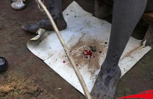 残害妇女的陋习,莫名其妙的野蛮风俗:割礼