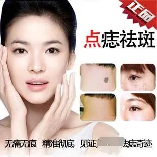 身上的黑痣该不该去除,身上的黑痣要不要点