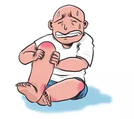 疫情期间痛风如何处理,痛风急性发作的小妙招与预防措施