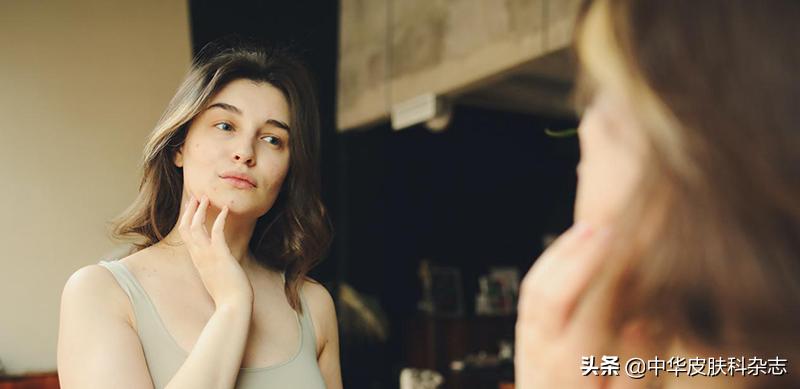 祛除痘疤痘印最好的产品,修复痘印痘坑痘疤的产品