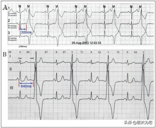脉象动态图,脉象动图