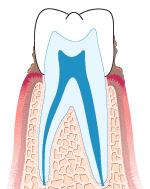 一直犹豫种不种牙，有什么建议吗？