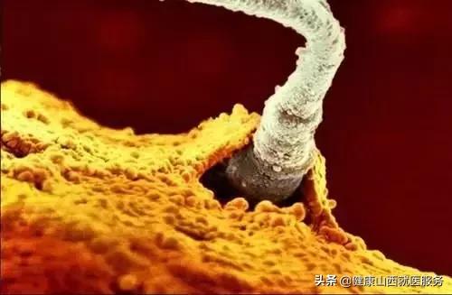 精子死精成活率低应怎么调理,精子是活的还是死的怎么判别