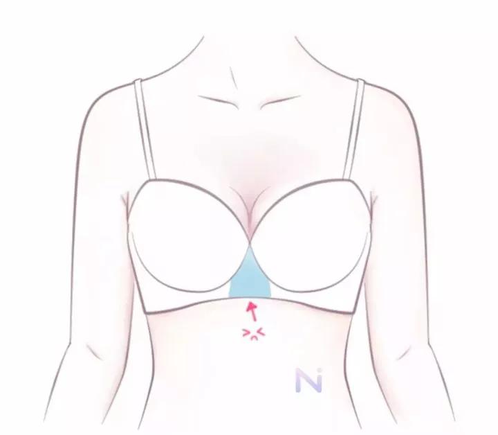 少一个乳房适合选什么内衣,适合乳房内陷的内衣