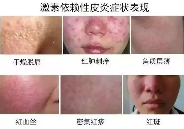 这些护肤的错误不要犯太伤皮肤,毁脸护肤的四大误区