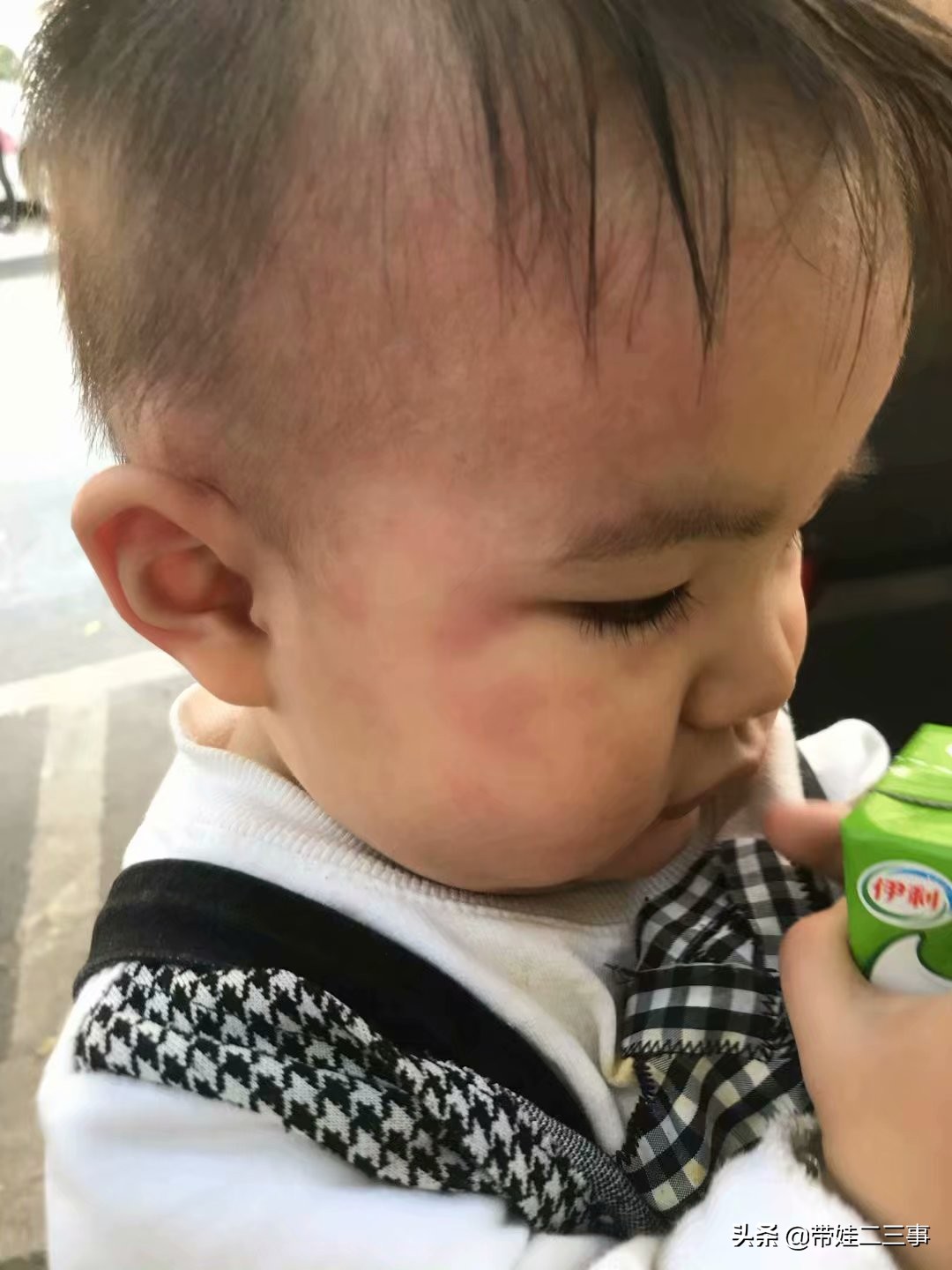 婴儿检查牛奶没过敏实际过敏,未满月的宝宝过敏怎么办