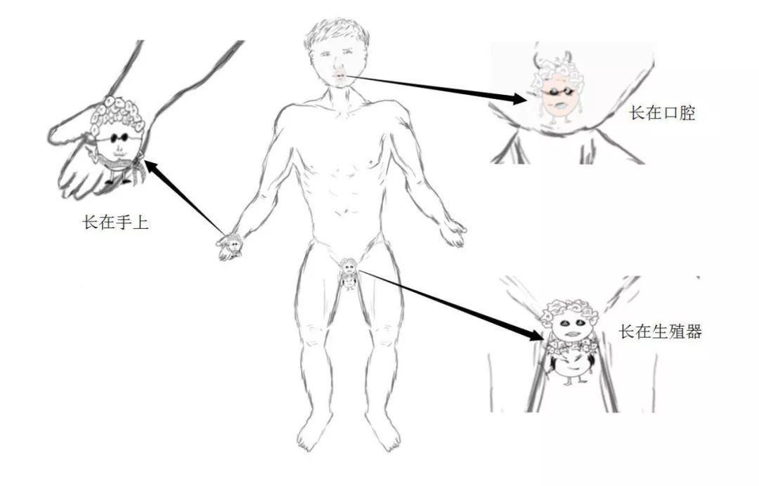 hpv低级病变可以备孕吗,Hpv感染及宫颈癌预防