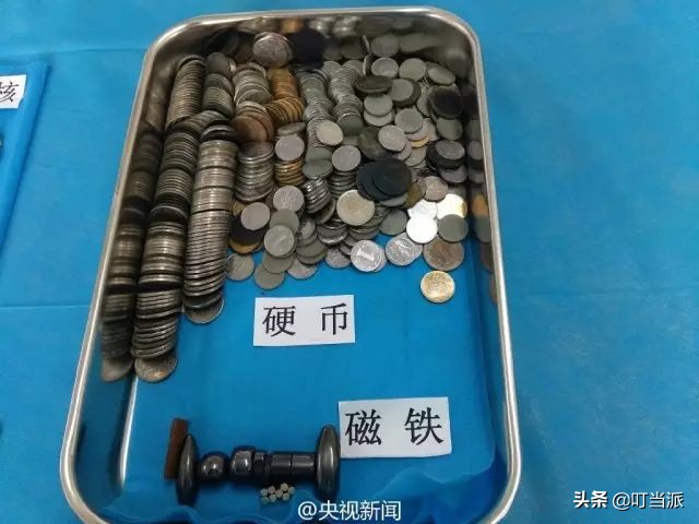 10岁孩子吞了个小钉子能排出吗,2岁宝宝误吞4厘米钉子