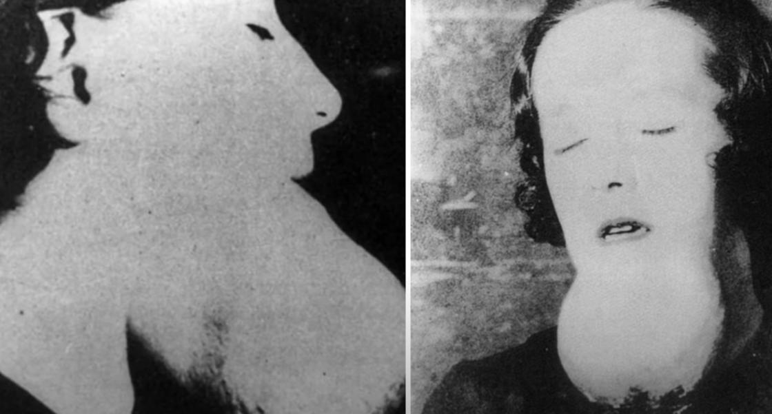 牙齿烂光，脸长巨瘤，骨头还会发光，被美国资本家逼向绝路的女工