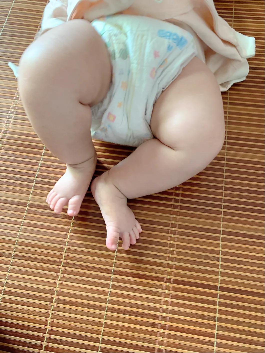 奶蛋白过敏的宝宝如何喂养,过敏宝宝该如何喂养