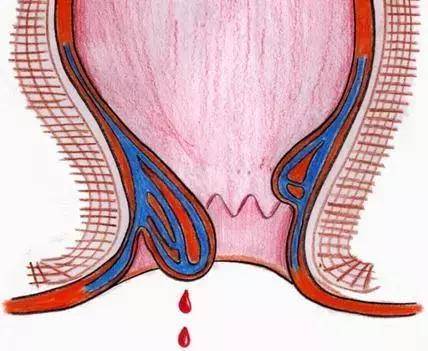 这里的痛,竟然让14年逃犯宁愿被抓也不愿意忍!