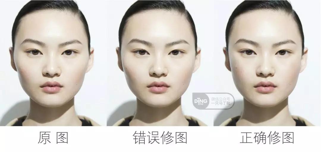 颧弓高脸型怎么改善,有泪沟可以通过调整脸型改善嘛