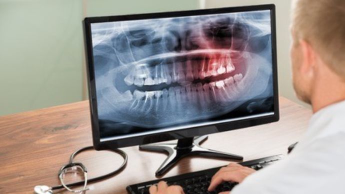 大过年智齿发炎,疫情时期智齿发炎怎么办