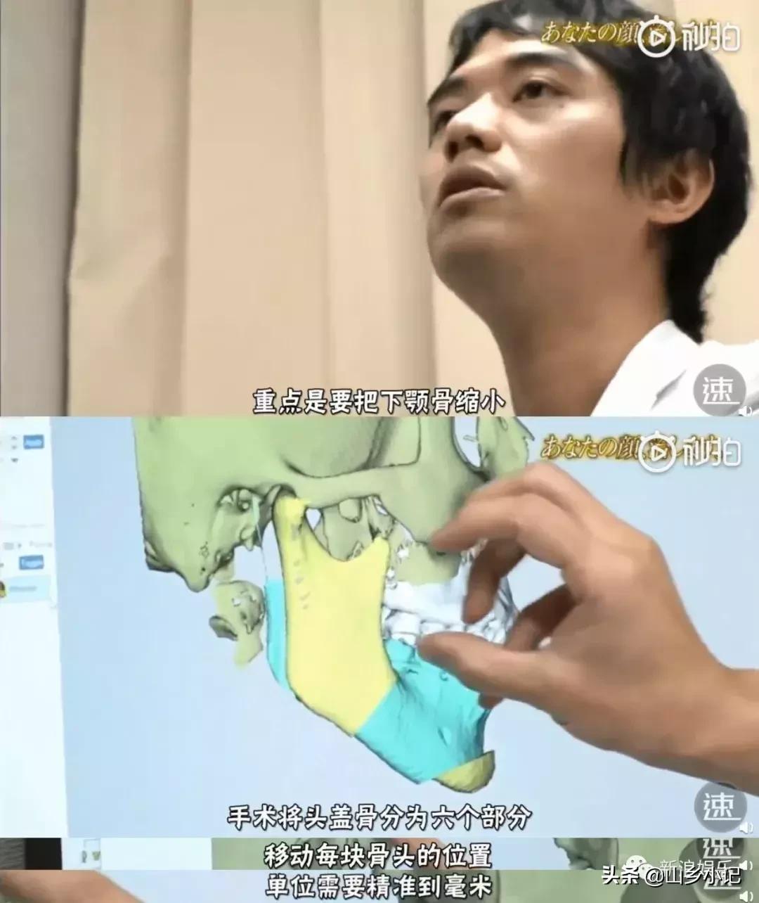 明明是整容脸现在却成了颜值巅峰,明明是整容脸却没被吐槽过