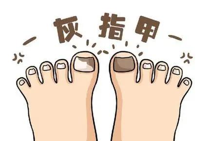 灰指甲治好后指甲变厚还是灰甲吗,灰指甲治好了指甲怎么还是厚的