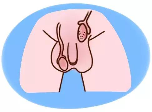 今天来讲讲男宝蛋蛋可能遭遇的那些事