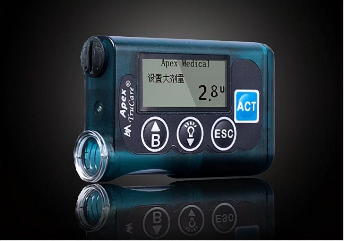 优泵胰岛素泵最新价格,德国胰岛素泵品牌及价格