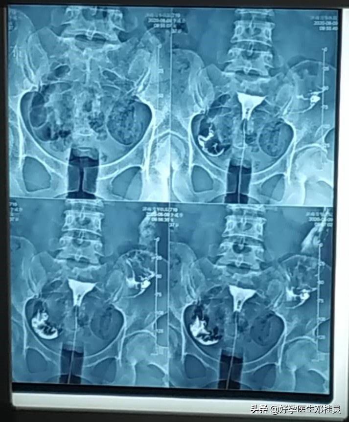科学备孕输卵管,科学备孕后怀孕几率