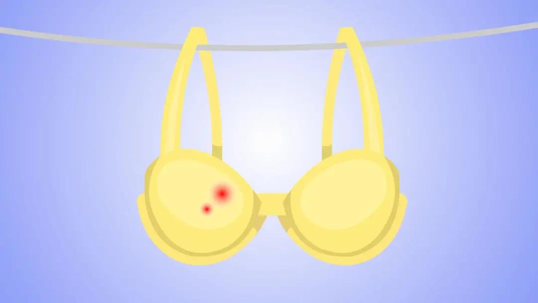 生娃后,4种妇科病别乱治!花了冤枉钱还伤身体