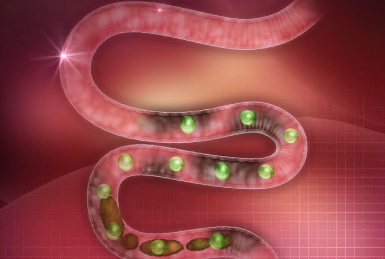 人体内真有6公斤宿便吗?怎么才能排出那些“赖着不走”的宿便?