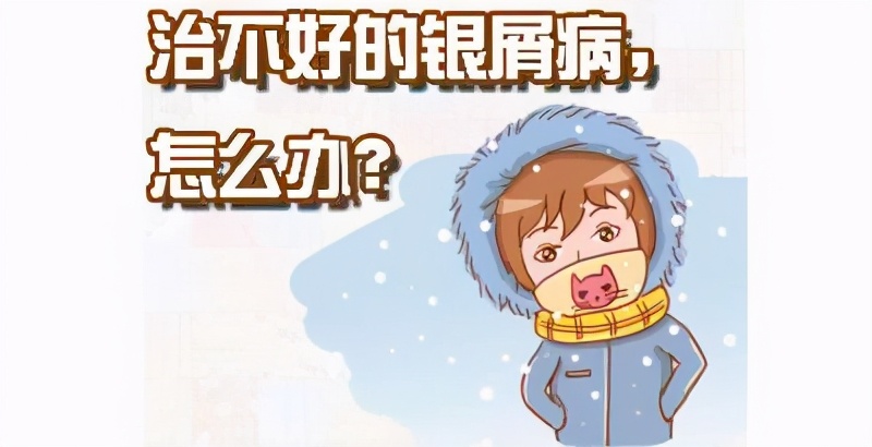 牛皮癣主要有哪几点认识误区,牛皮癣治疗别有弯路