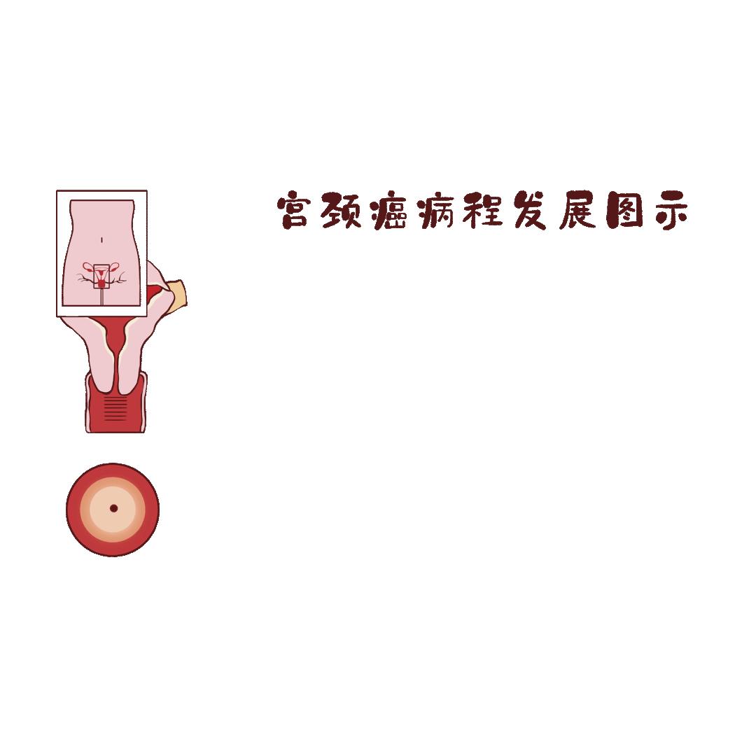 女性hpv疫苗免费了吗,蚌埠打四价hpv疫苗怎么网上预约