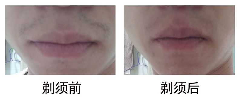 米家电动剃须刀5刀头说明书,米家电动剃须刀往复五刀头测评