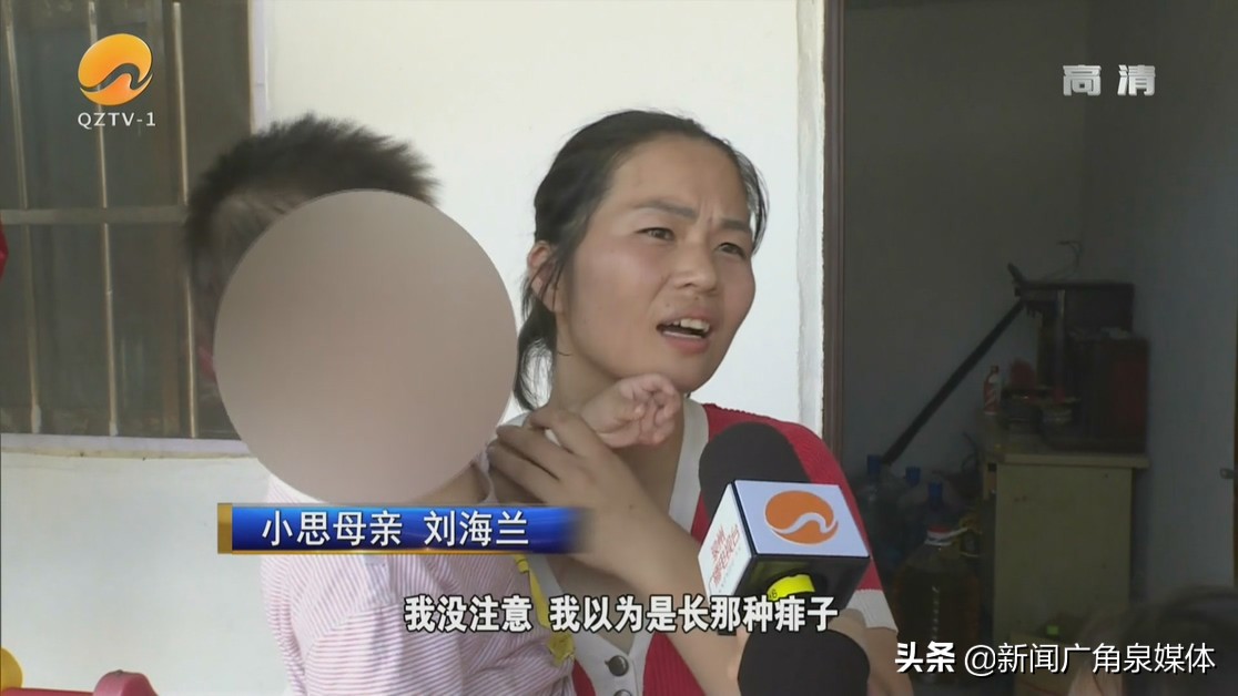 接种疫苗后14月龄宝宝全身起红疹