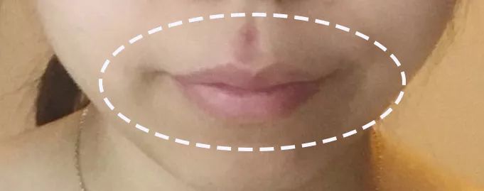 求改善痘痘真实办法,想改变脸上痘痘