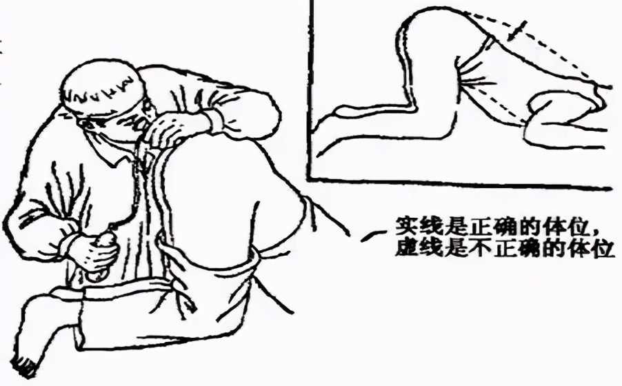 华人回国“肛拭子”检测：被捅2次每次10秒，虽然尴尬但理解