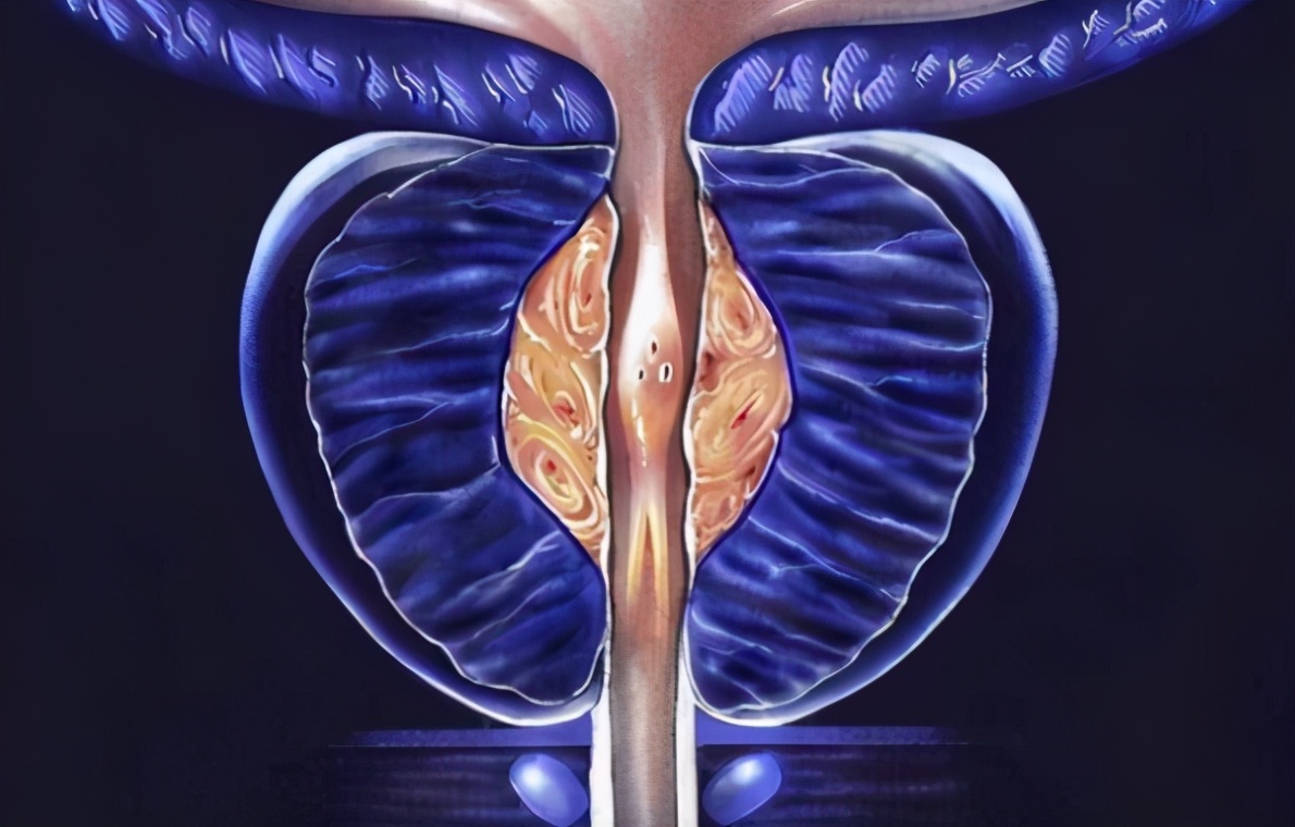 21岁小伙查出前列腺炎,30天后痊愈,他是如何做的?方法值得借鉴