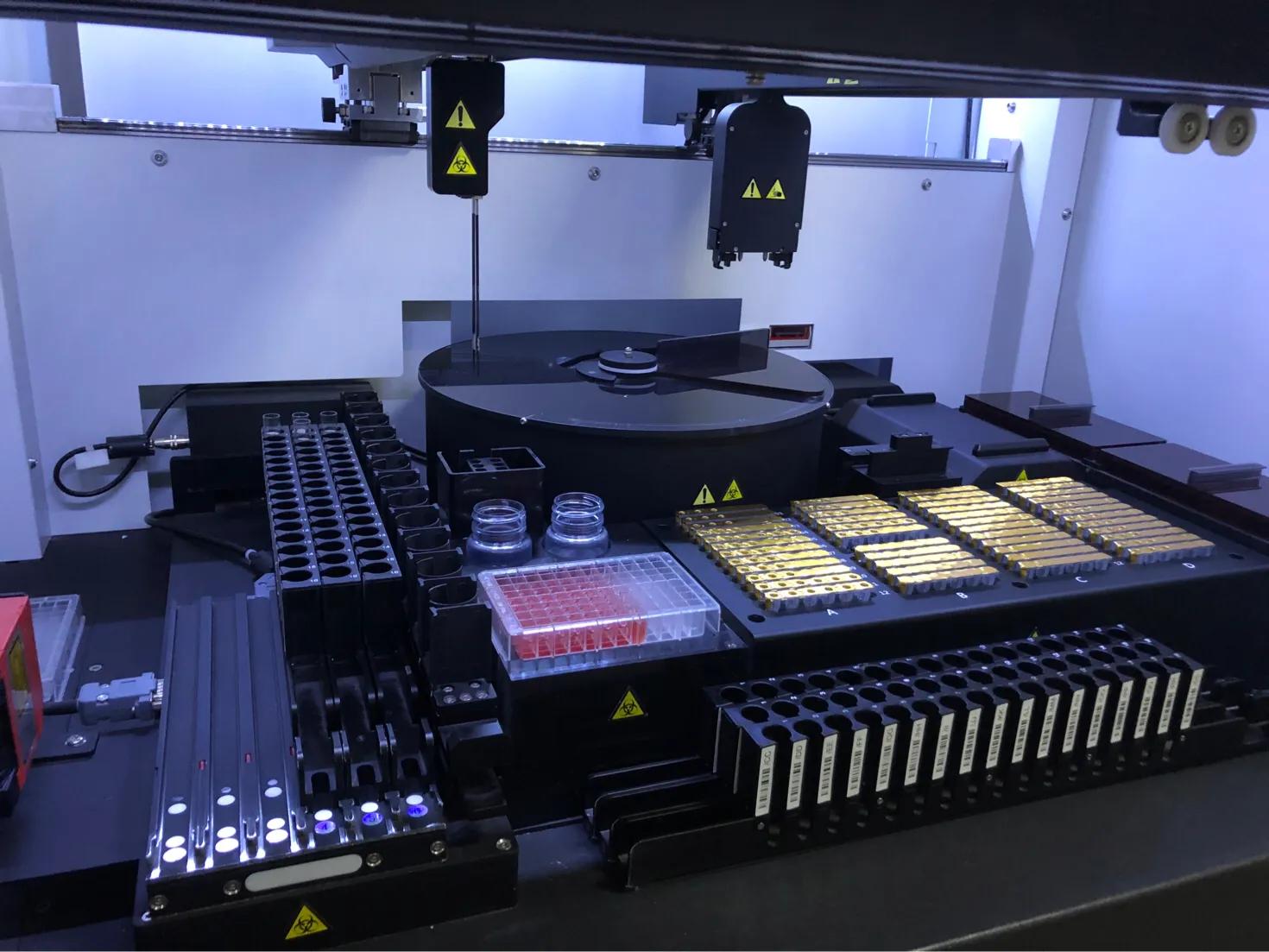 总胆汁酸高吃什么食物比较好,总胆汁酸100多意味着什么