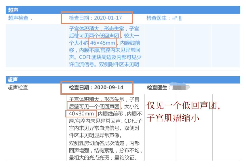 气出来的子宫肌瘤,气出来的乳腺结节会消吗