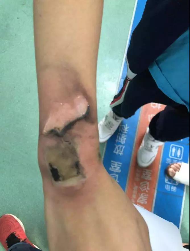 紧急提醒孩子天天用的东西,紧急提醒孩子带什么东西