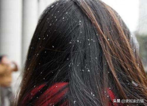 头屑多痒什么洗发水比较好,最有效的去油去头屑的洗发水