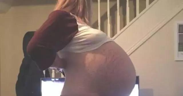 孕检很重要,怀孕会让卵巢囊肿跟着变大吗