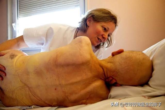 老人骨折卧床便秘怎么办,老年人骨折后老是恶心呕吐