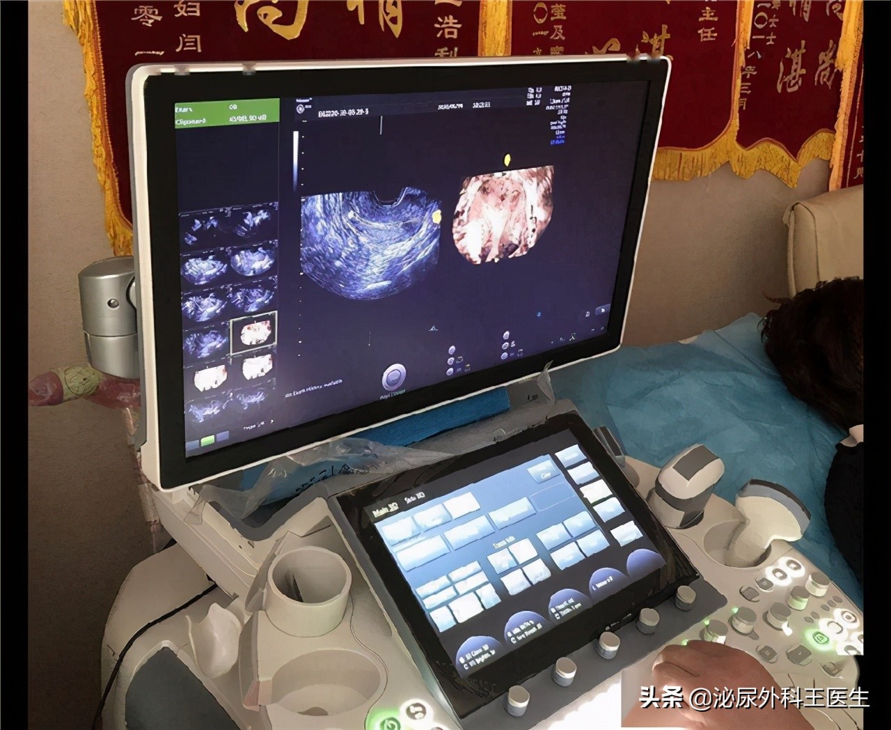 什么是阴式b超检查时有什么感觉,阴式b超检查前注意事项