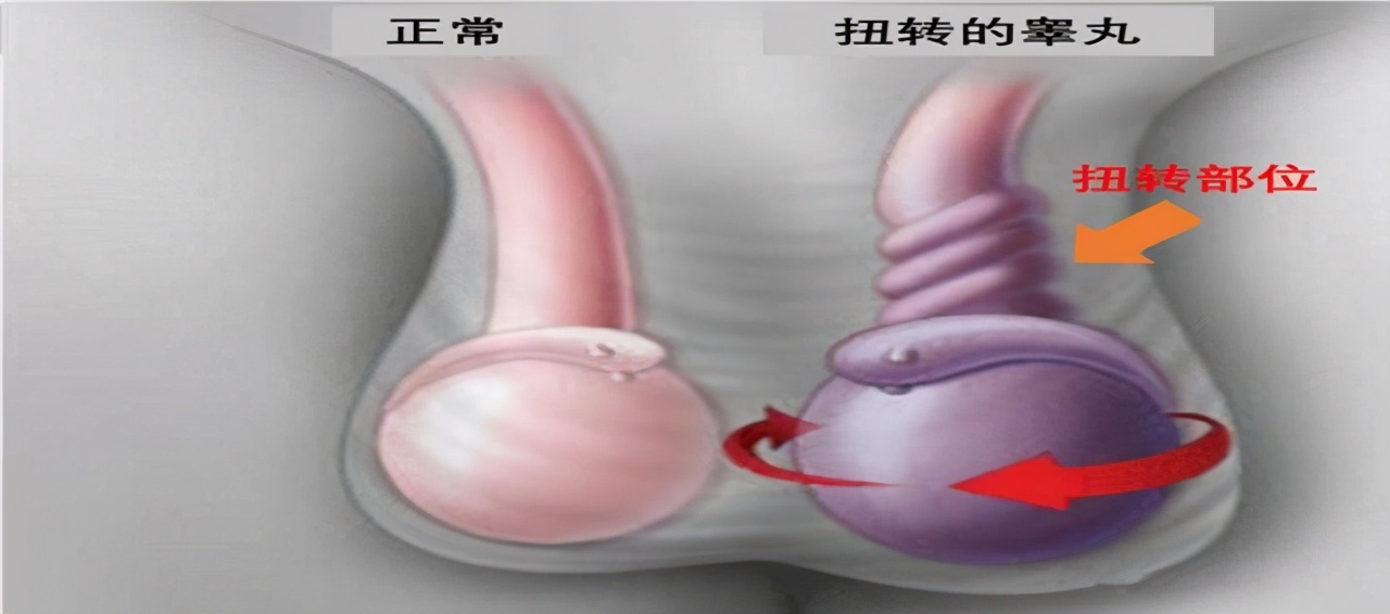 男性健康日应该准备什么,全国男性健康日