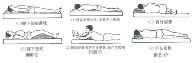 o型腿怎样矫正过来,严重o型腿怎么矫正最有效的动作