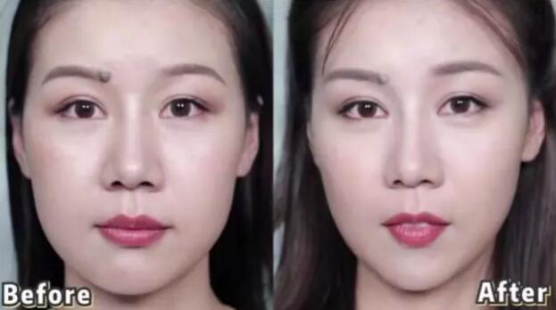 脸太大有什么方法变小吗,脸太大怎么让脸变小整形