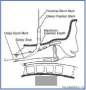 干货：气管切开术及护理措施