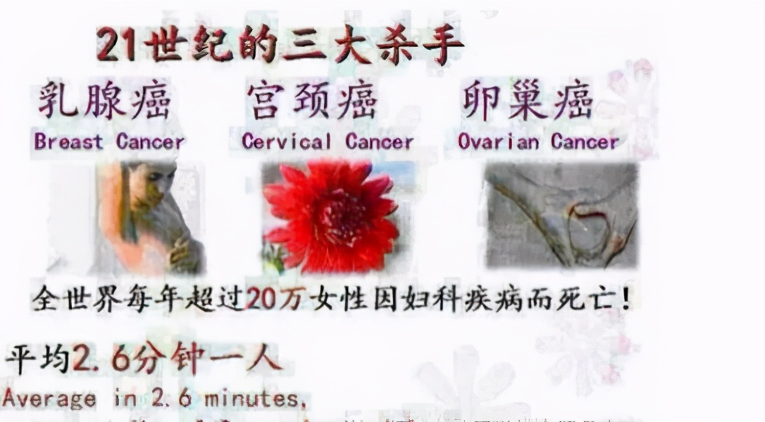 北京协和医院妇科专家杨毅,北京治疗hpv杨毅