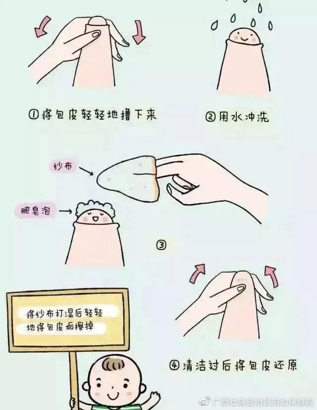 鍖呯毊杩囬暱鐨勭棁鐘跺拰鍗卞鍎跨绉戞櫘,瀹堕暱鎬庝箞瀵瑰皬瀛╄棰勯槻鍖呯毊杩囬暱