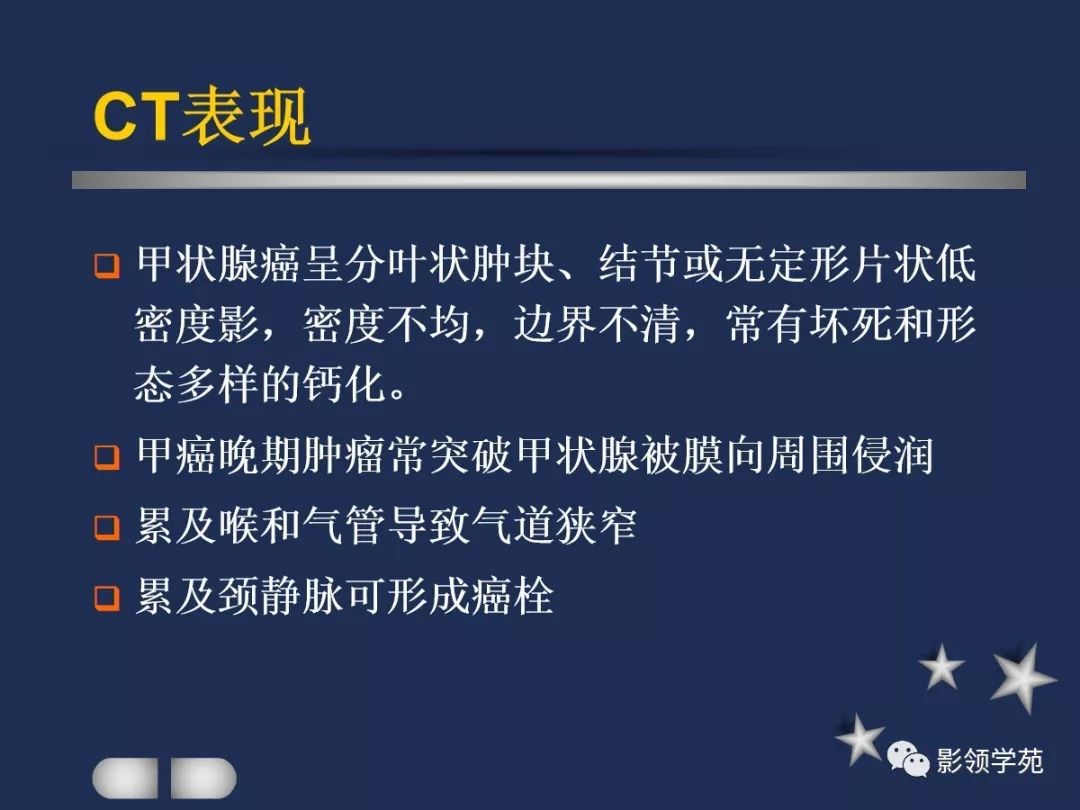 腮腺疾病影像学诊断,腮腺肿块影像诊断