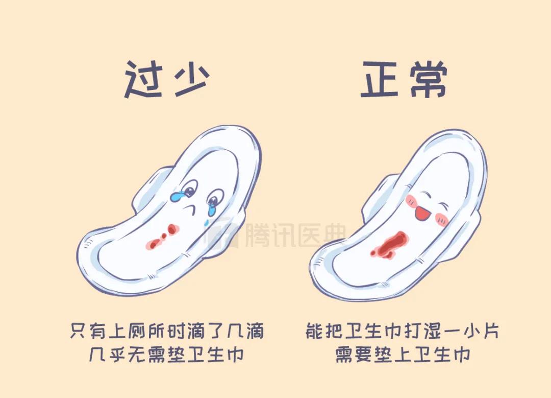 月经突然减少要做什么检查,48岁月经突然变少会绝经吗