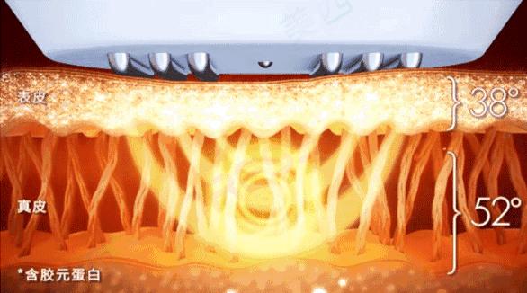 美白微针和水光针的区别,水光针和微针光子嫩肤哪个好