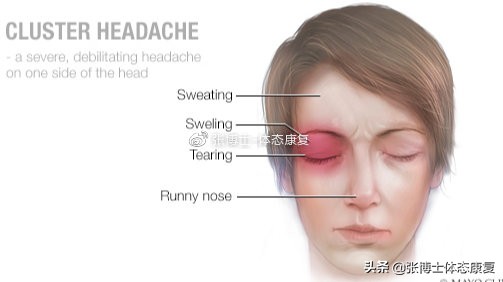 头痛康复锻炼方法,运动导致的头痛怎么缓解