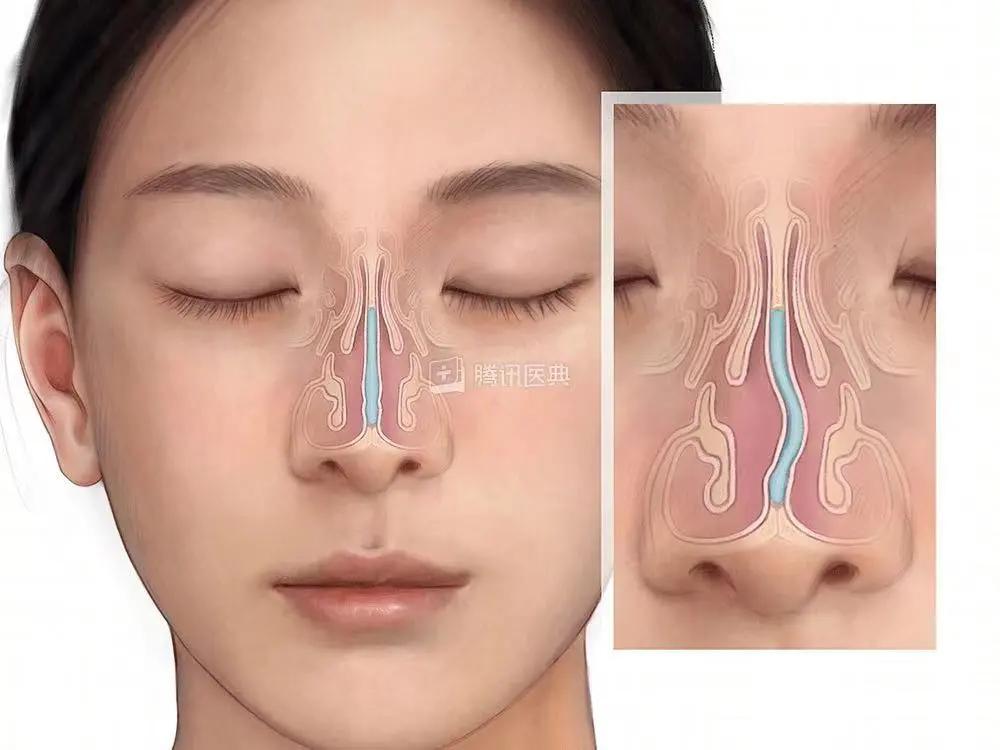 香港富商都是去内地看病吗,香港大佬开奔驰去医院